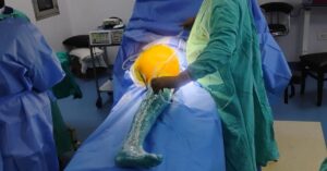 Hip replacement surgery in Indore