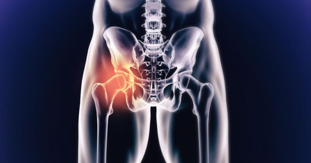 hip replacement specialist in indore, orthopedic in indore