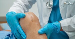 knee replacement in indore