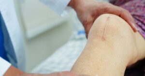 knee replacement surgery in indore