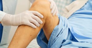 knee replacement surgery in indore