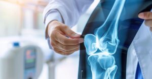 orthopaedic doctor in indore