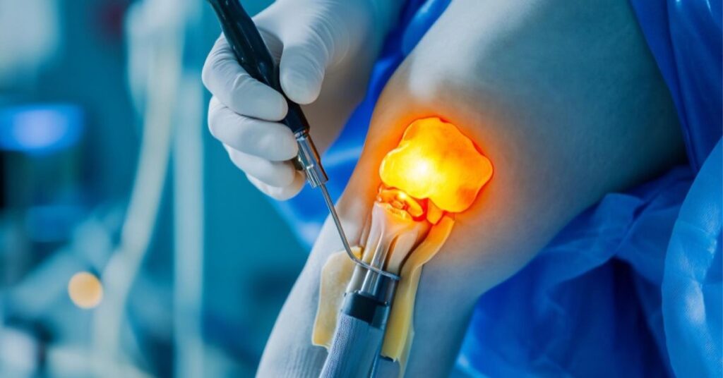 orthopedic surgeon in indore