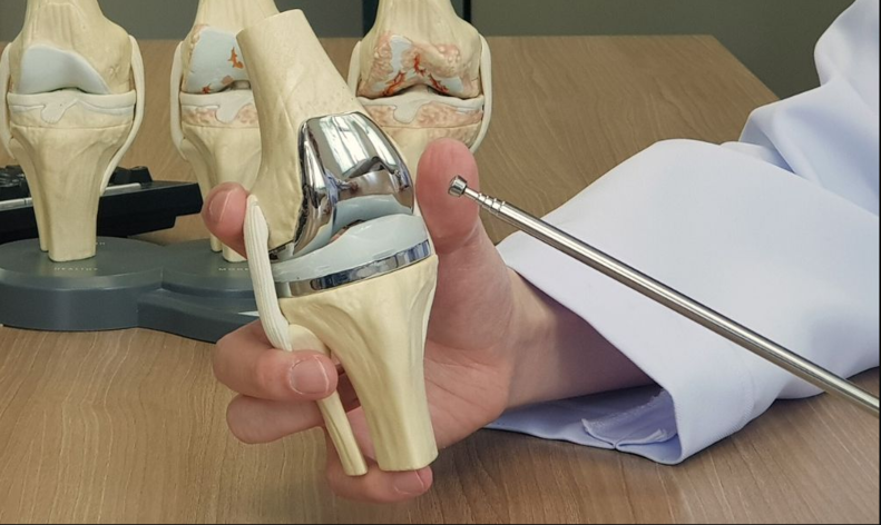 Knee Replacement Surgery in Indore