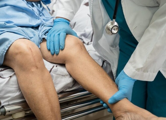 Knee Replacement Surgery in Indore