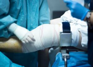 Fracture Surgery in Indore