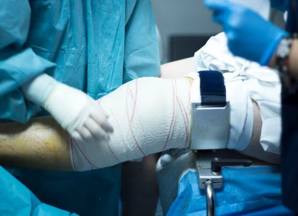 Fracture Surgery in Indore
