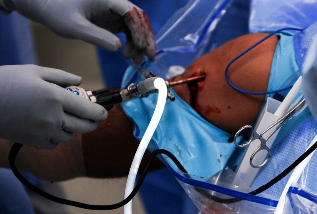 Orthopedic Surgeon in Indore