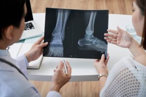 Fracture Surgery in Indore