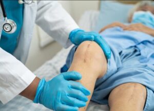 Knee Replacement Surgery in Indore