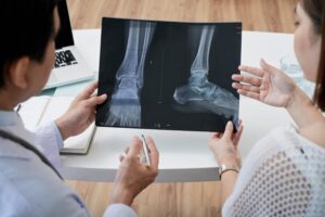 Fracture Surgery in Indore