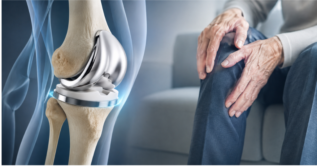 total knee replacement in indore