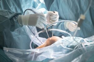 Best Orthopedic Surgeon in Indore